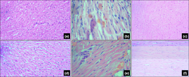Comparison of the protective effects of vanillic and rosmarinic acid on cardiac tissue: Lower limb ischemia-reperfusion model in rats.