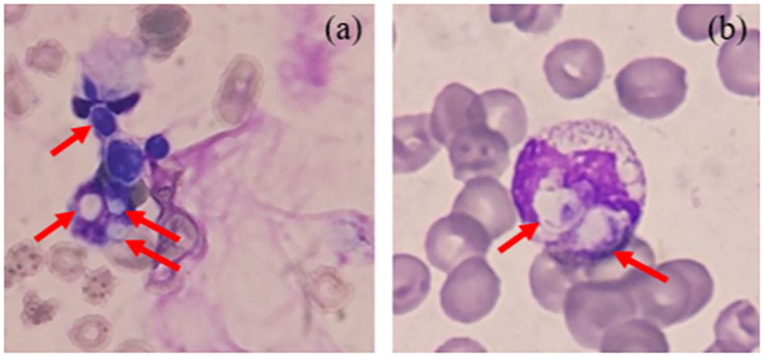 A Simple, Fast, and Reliable Method for the Identification of <i>Candida albicans</i>.