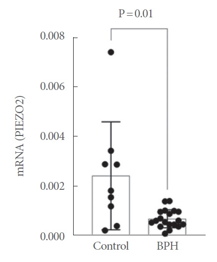 Downregulation of PIEZO2 in the Detrusor of Men With Bladder Outlet Obstruction and Its Association With Urinary Retention and Decreased Bladder Compliance.
