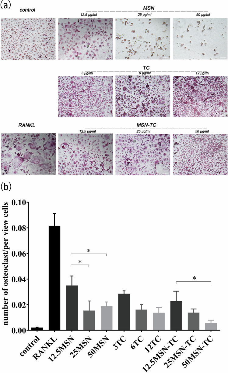 Inhibitory impact of a mesoporous silica nanoparticle-based drug delivery system on Porphyromonas gingivalis-induced bone resorption