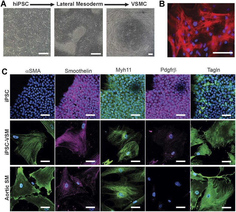 Electrophysiology of Human iPSC-derived Vascular Smooth Muscle Cells and Cell-autonomous Consequences of Cantú Syndrome Mutations.
