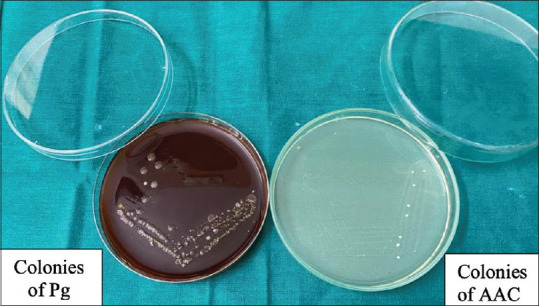 Evaluation of antimicrobial activity of platelet-rich fibrin and titanium platelet-rich fibrin with and without incorporation of antibiotics on <i>Porphyromonas gingivalis</i> and <i>Aggregatibacter actinomycetemcomitans</i>: An <i>in vitro</i> study.