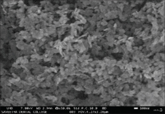 Development and characterization of novel magnesium oxide nanoparticle-impregnated chitosan-based guided tissue regeneration membrane - An <i>in vitro</i> study.
