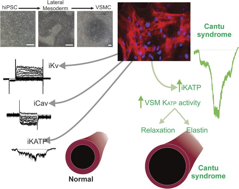 Electrophysiology of Human iPSC-derived Vascular Smooth Muscle Cells and Cell-autonomous Consequences of Cantú Syndrome Mutations.
