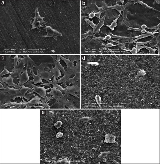 Cytotoxicity of dental ceramic materials on human gingival fibroblasts.