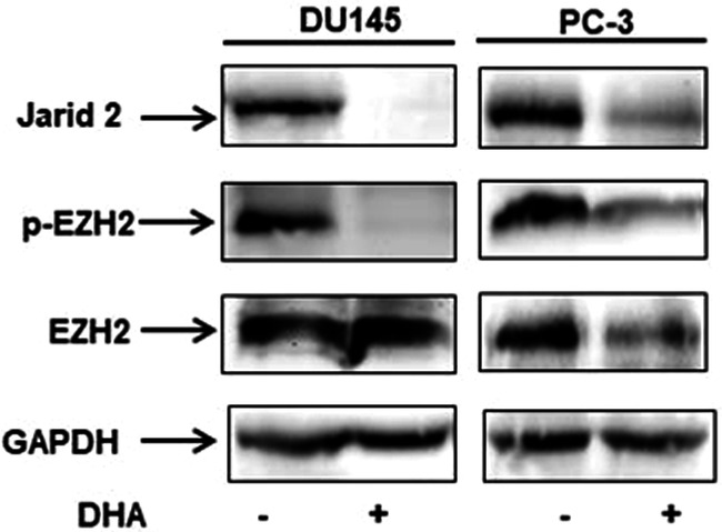 Correction: Dihydroartemisinin inhibits prostate cancer via JARID2/miR-7/miR-34a-dependent downregulation of Axl.