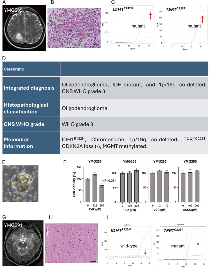 Translational Research Platform for Malignant Central Nervous System Tumors.