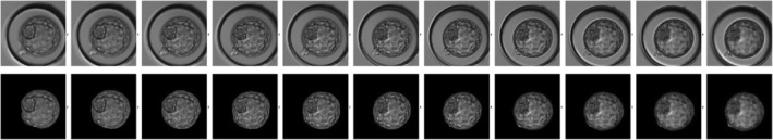 Predicting implantation by using dual AI system incorporating three-dimensional blastocyst image and conventional embryo evaluation parameters-A pilot study.