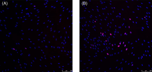 High-powered 675-nm laser: Safety and efficacy in clinical evaluation and in vitro evidence for different skin disorders.