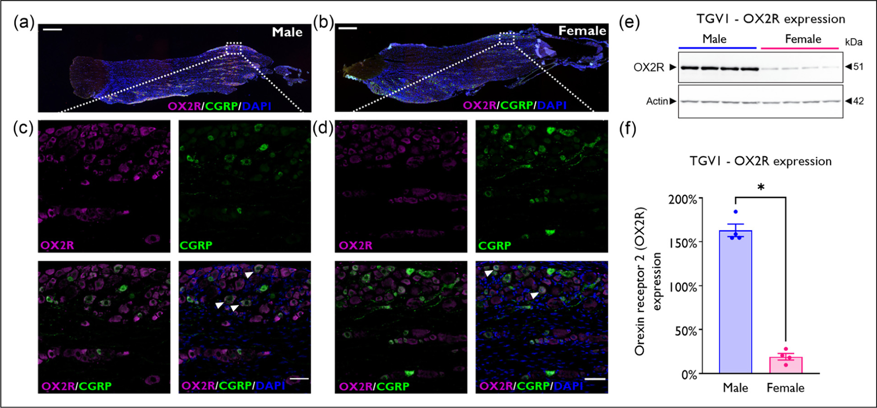 A male-specific mechanism of meningeal nociceptor sensitization promoting migraine headache.