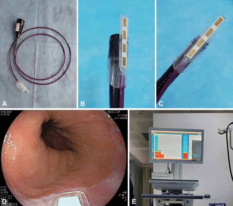 Novel Technique to Diagnose Gastroesophageal Reflux Disease.