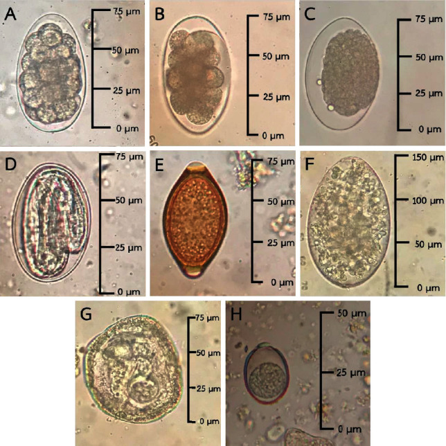 Prevalence and Associated Risk Factors of Gastrointestinal Parasite Infections among Meat Goats in Khon Kaen Thailand.