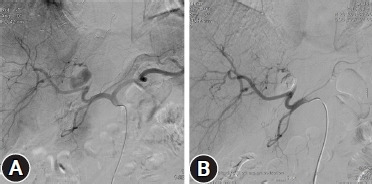 Experience of vascular injuries at a military hospital in Korea.