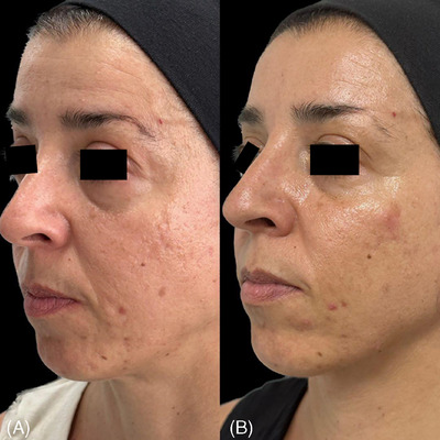 High-powered 675-nm laser: Safety and efficacy in clinical evaluation and in vitro evidence for different skin disorders.