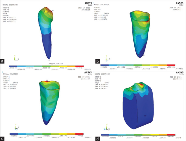 Evaluation of effects of different sizes and shapes of attachments during rotation, tipping, and torquing in clear aligner therapy - A finite element study.