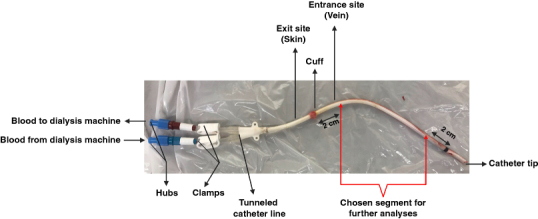 Microbiological analysis of tunneled hemodialysis catheters isolated from patients receiving hemodialysis in Saskatchewan.