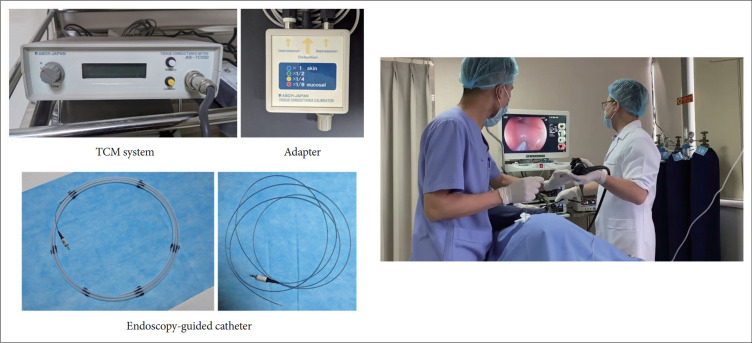 Novel Technique to Diagnose Gastroesophageal Reflux Disease.