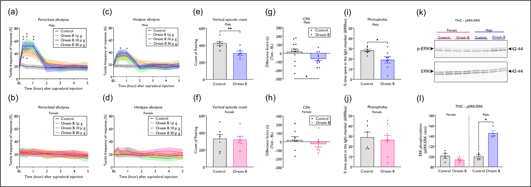 A male-specific mechanism of meningeal nociceptor sensitization promoting migraine headache.