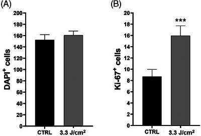 High-powered 675-nm laser: Safety and efficacy in clinical evaluation and in vitro evidence for different skin disorders.