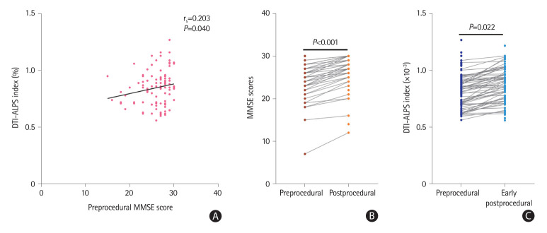 Early Improvement in Interstitial Fluid Flow in Patients With Severe Carotid Stenosis After Angioplasty and Stenting.