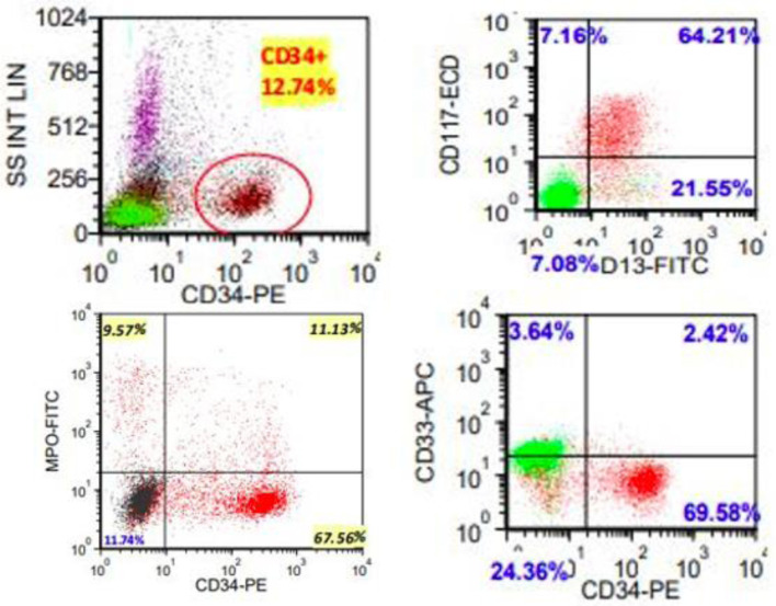 Clinical, Phenotypic and Molecular Characterization of <i>NUP214-ABL1</i> Fusion Positive Myeloid Malignancies.