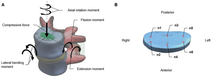 Mechanical influence of facet tropism in patients with chronic discogenic pain disorder.