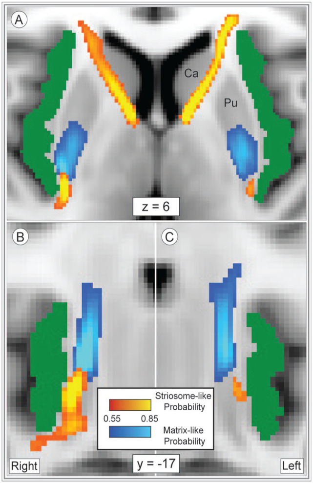 In Humans, Insulo-striate Structural Connectivity is Largely Biased Toward Either Striosome-like or Matrix-like Striatal Compartments.