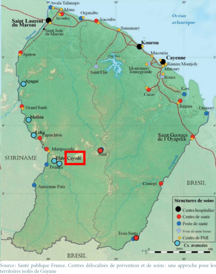 [Fatal case of co-infection with yellow fever virus and SARS-CoV2 during the 2020 Covid-19 pandemic in French Guiana].
