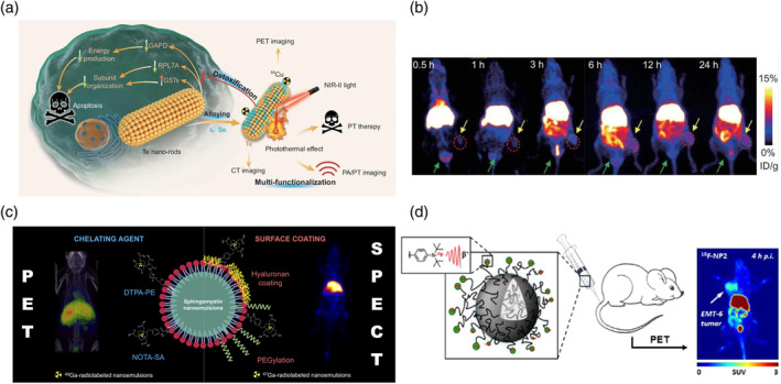Nanoscale Radiotheranostics for Cancer Treatment: From Bench to Bedside.