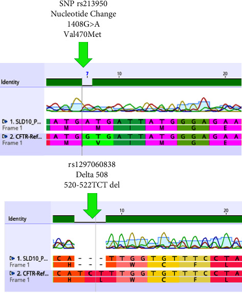 Case Study: Analyzing CFTR Mutations and SNPs in Pulmonary Fibrosis Patients with Unclear Symptoms.