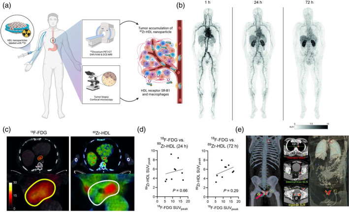 Nanoscale Radiotheranostics for Cancer Treatment: From Bench to Bedside.