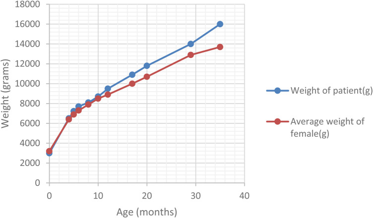Alström syndrome-wide clinical variability within the same variant: a case report and literature review.