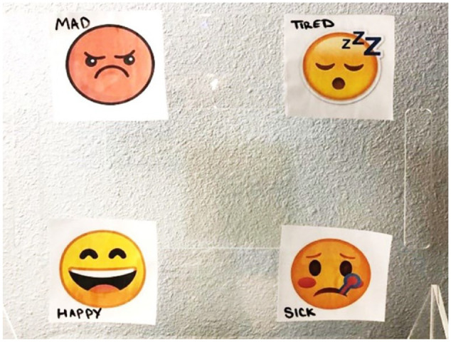 Successful use of an eye gaze AAC communication board by a young adult with advanced Sanfilippo Syndrome (MPS IIIA): Case report.