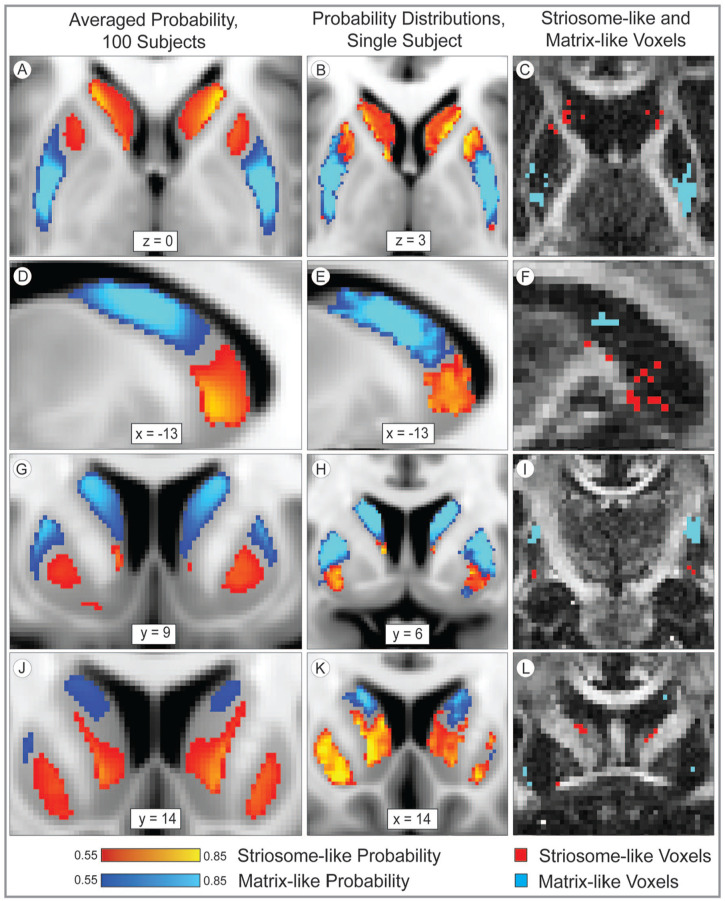 In Humans, Insulo-striate Structural Connectivity is Largely Biased Toward Either Striosome-like or Matrix-like Striatal Compartments.