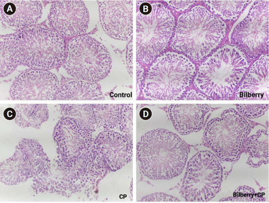Potential ameliorative effects of bilberry (Vaccinium myrtillus L.) fruit extract on cisplatin-induced reproductive damage in adult male albino rats.