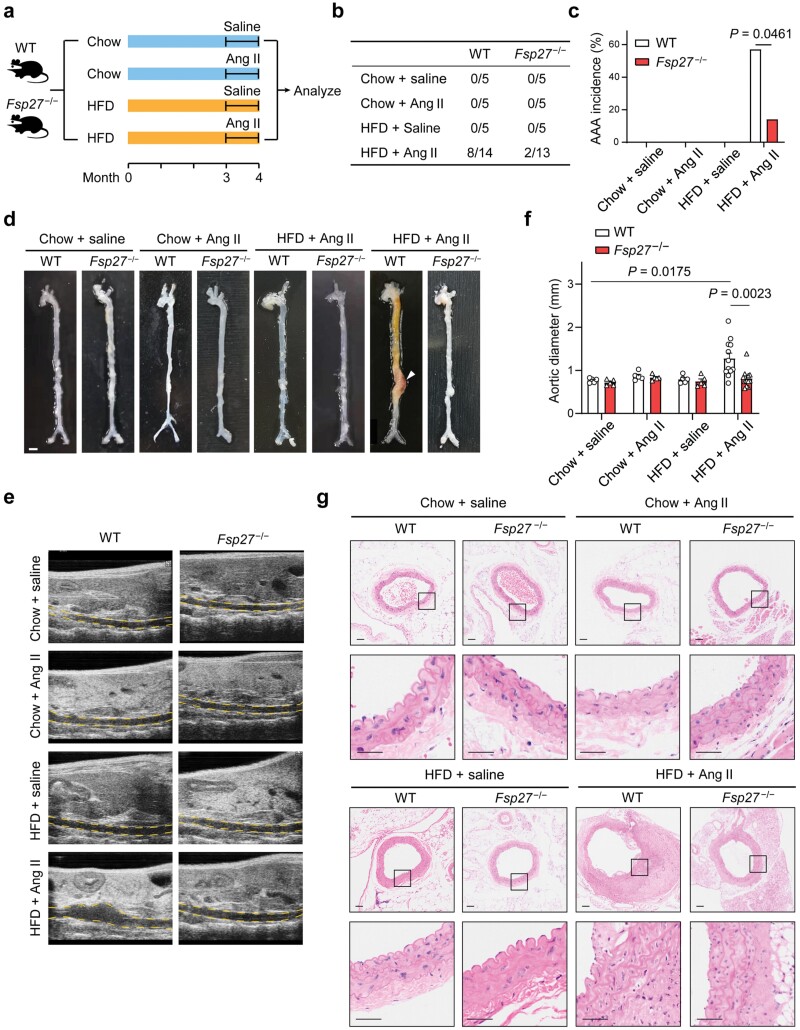 CIDEC/FSP27 exacerbates obesity-related abdominal aortic aneurysm by promoting perivascular adipose tissue inflammation.