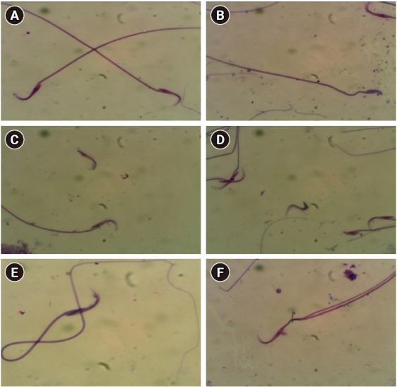 Potential ameliorative effects of bilberry (Vaccinium myrtillus L.) fruit extract on cisplatin-induced reproductive damage in adult male albino rats.