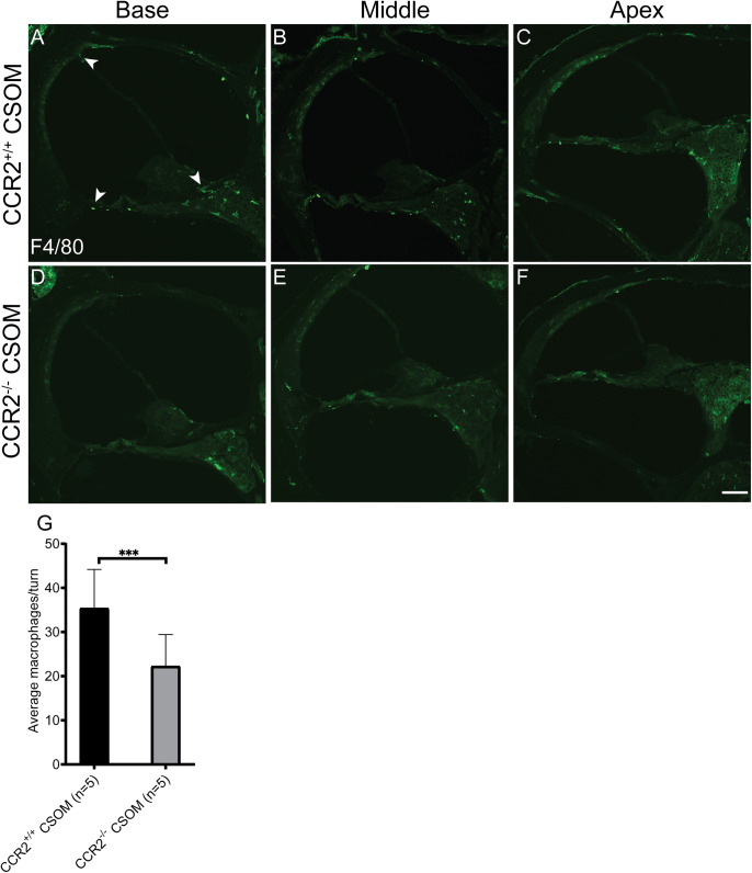 Chemokine Receptor CCR2 Is Protective toward Outer Hair Cells in Chronic Suppurative Otitis Media.