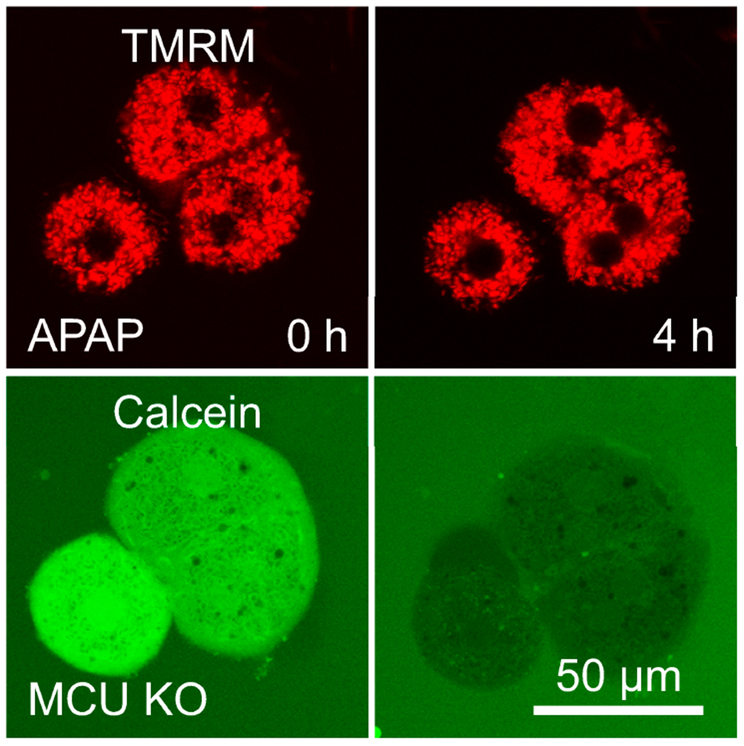 Role of Mitochondrial Iron Uptake in Acetaminophen Hepatotoxicity.