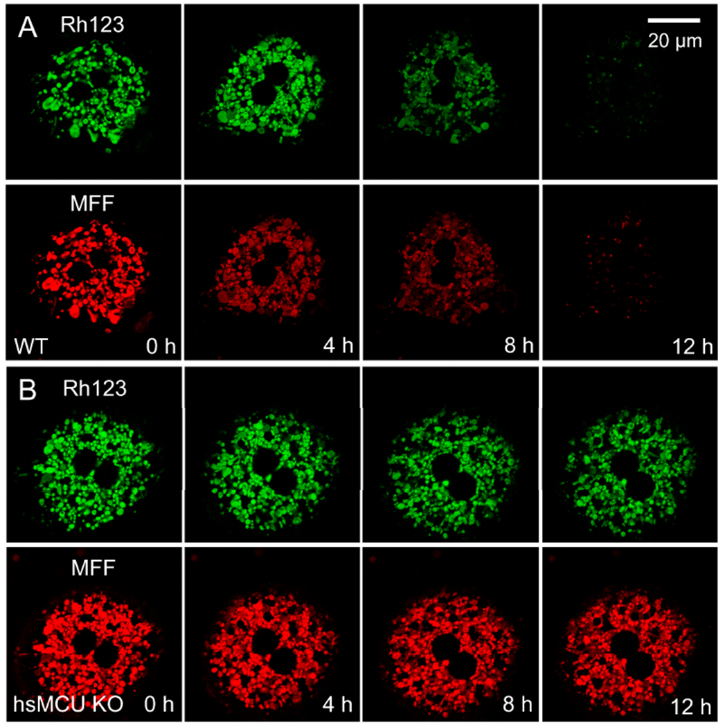 Role of Mitochondrial Iron Uptake in Acetaminophen Hepatotoxicity.