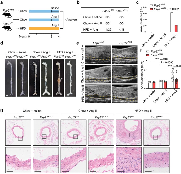 CIDEC/FSP27 exacerbates obesity-related abdominal aortic aneurysm by promoting perivascular adipose tissue inflammation.