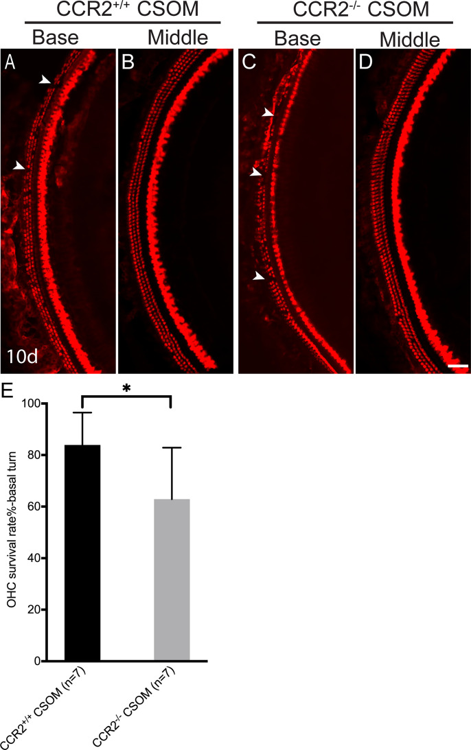 Chemokine Receptor CCR2 Is Protective toward Outer Hair Cells in Chronic Suppurative Otitis Media.