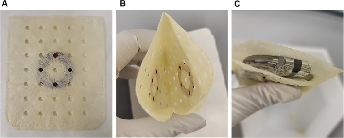 Preclinical evaluation of a novel antibiotic-eluting BioEnvelope for CIED infection prevention.