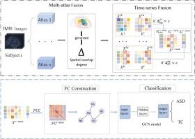 MAFT-SO: A novel multi-atlas fusion template based on spatial overlap for ASD diagnosis