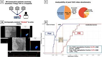 Quantitative Aortography Analysis of JenaValve’s Trilogy Transcatheter Aortic Valve Implantation System in Patients With Aortic Regurgitation or Stenosis