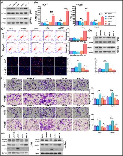 Hepatocellular carcinoma and AIM2: Therapeutic potential through regulation of autophagy and macrophage polarization