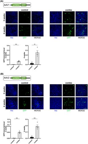 Accelerated maturation of ARPE-19 cells for the translational assessment of gene therapy