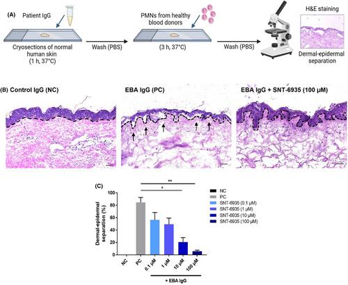 Granzyme B inhibition reduces autoantibody-induced dermal–epidermal separation in an ex vivo model of epidermolysis bullosa acquisita