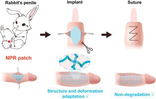 Dynamic compliance penis enlargement patch