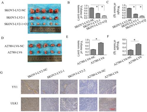 CircFAM188A Regulates Autophagy via miR-670-3p and ULK1 in Epithelial Ovarian Carcinoma